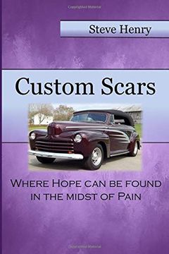 portada Custom Scars: Where Hope can be Found in the Midst of Pain (en Inglés)