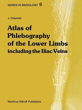 portada Atlas of Phlebography of the Lower Limbs: Including the Iliac Veins (en Inglés)