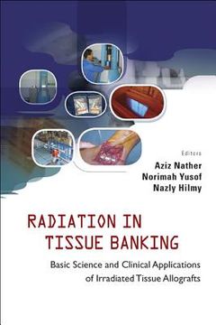 Radiation in Tissue Banking: Basic Science and Clinical Applications of Irradiated Tissue Allografts (en Inglés)