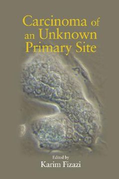 portada carcinoma of an unknown primary site (en Inglés)