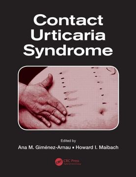 portada Contact Urticaria Syndrome (en Inglés)
