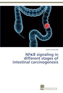 portada NFB signaling in different stages of intestinal carcinogenesis