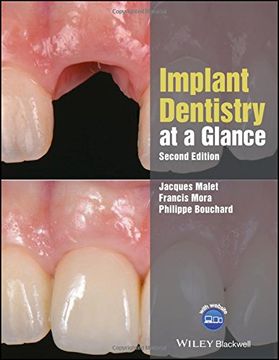 portada Implant Dentistry at a Glance (at a Glance (Dentistry)) (en Inglés)