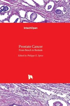 portada Prostate Cancer: From Bench to Bedside (en Inglés)