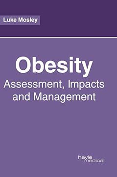 portada Obesity: Assessment, Impacts and Management (en Inglés)