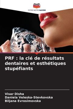 portada Prf: la clé de résultats dentaires et esthétiques stupéfiants (en Francés)