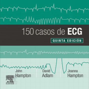 portada 150 Casos de ecg (in Spanish)