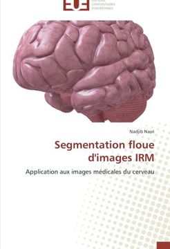 portada Segmentation floue d'images IRM: Application aux images médicales du cerveau