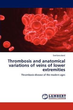 portada thrombosis and anatomical variations of veins of lower extremities