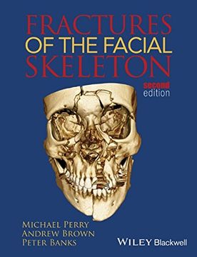 portada Fractures of the Facial Skeleton
