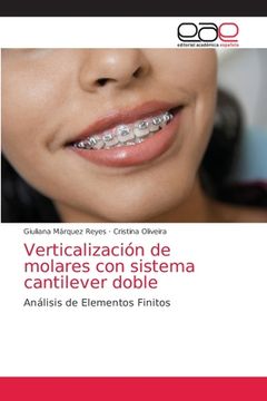 portada Verticalización de molares con sistema cantilever doble (in Spanish)