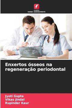 portada Enxertos Ósseos na Regeneração Periodontal (en Portugués)