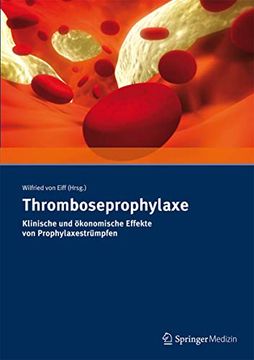 portada Thromboseprophylaxe Klinische und Ökonomische Effekte von Prophylaxestrümpfen (en Alemán)