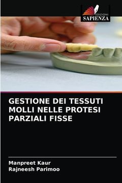 portada Gestione Dei Tessuti Molli Nelle Protesi Parziali Fisse (in Italian)