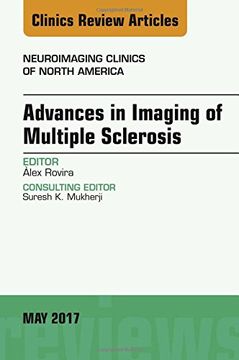 portada Advances in Imaging of Multiple Sclerosis, An Issue of Neuroimaging Clinics of North America, 1e (The Clinics: Radiology)