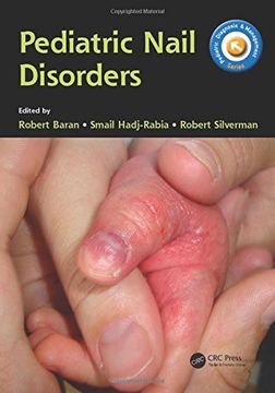 portada Pediatric Nail Disorders (en Inglés)