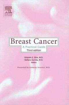 portada breast cancer: a practical guide