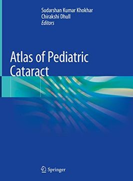 portada Atlas of Pediatric Cataract (en Inglés)