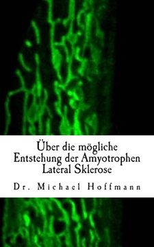 portada Über die mögliche Entstehung der Amyotrophen Lateral Sklerose (in German)