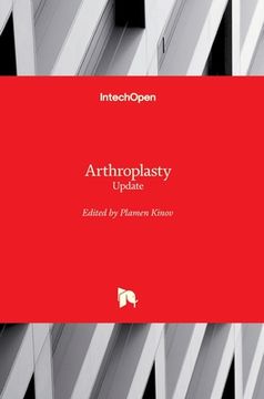 portada Arthroplasty: Update (in English)