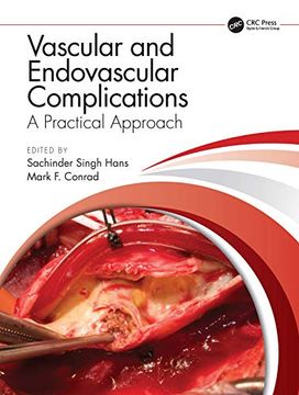 portada Vascular and Endovascular Complications: A Practical Approach (en Inglés)