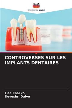 portada Controverses Sur Les Implants Dentaires (en Francés)