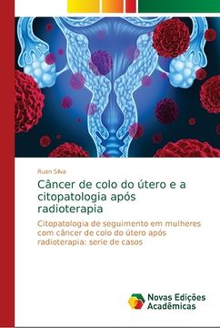 portada Câncer de Colo do Útero e a Citopatologia Após Radioterapia (en Portugués)