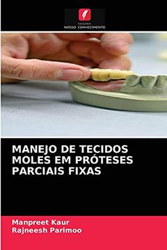 portada Manejo de Tecidos Moles em Próteses Parciais Fixas (in Portuguese)
