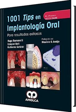 portada 1001 Tips en Implantología Oral Para Resultados Exitosos + Videos Online