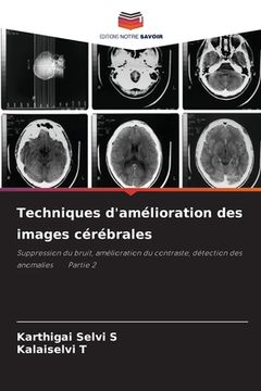 portada Techniques d'amélioration des images cérébrales (en Francés)