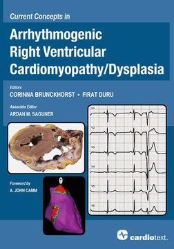 portada Current Concepts in Arrhythmogenic Right Ventricular Cardiomyopathy (en Inglés)