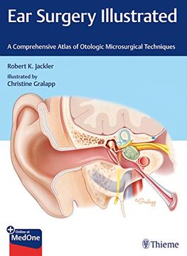 portada Ear Surgery Illustrated: A Comprehensive Atlas of Otologic Microsurgical Techniques (in English)