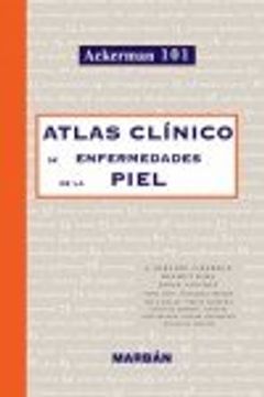 Atlas clinico de las 101 enfermedades mas comunes de la piel