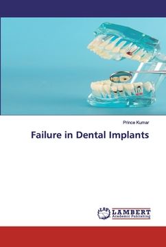portada Failure in Dental Implants (en Inglés)