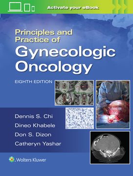 portada Principles and Practice of Gynecologic Oncology