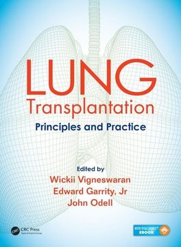 portada Lung Transplantation: Principles and Practice (in English)