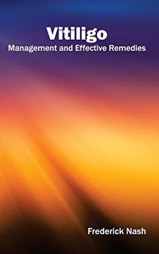 portada Vitiligo: Management and Effective Remedies 