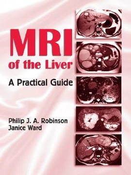 portada mri of the liver: a practical guide (en Inglés)