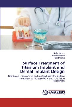 portada Surface Treatment of Titanium Implant and Dental Implant Design