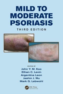 portada Mild to Moderate Psoriasis (en Inglés)