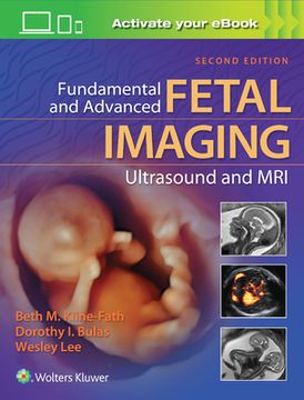 Fundamental and Advanced Fetal Imaging Ultrasound and MRI (en Inglés)