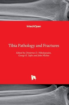 portada Tibia Pathology and Fractures (en Inglés)