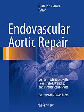 portada Endovascular Aortic Repair: Current Techniques With Fenestrated, Branched and Parallel Stent-Grafts (en Inglés)