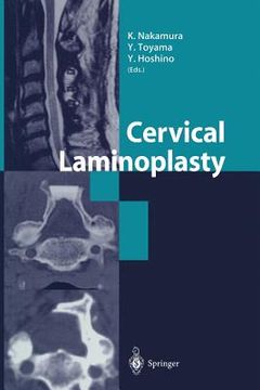 portada Cervical Laminoplasty (en Inglés)