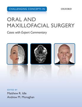 portada Challenging Concepts in Oral and Maxillofacial Surgery: Cases With Expert Commentary (Challenging Cases) (en Inglés)