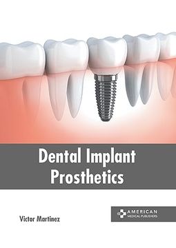 portada Dental Implant Prosthetics (en Inglés)