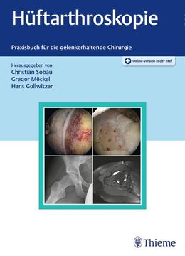 portada Hüftarthroskopie: Praxisbuch für die Gelenkerhaltende Chirurgie (in German)