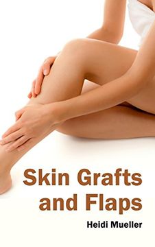 portada Skin Grafts and Flaps (in English)