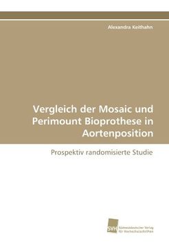 portada Vergleich der Mosaic und Perimount Bioprothese in Aortenposition: Prospektiv randomisierte Studie
