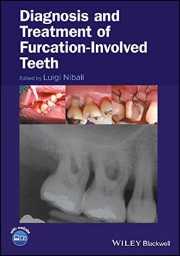 portada Diagnosis and Treatment of Furcation-Involved Teeth